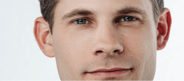 Sisu Microdermabrasion