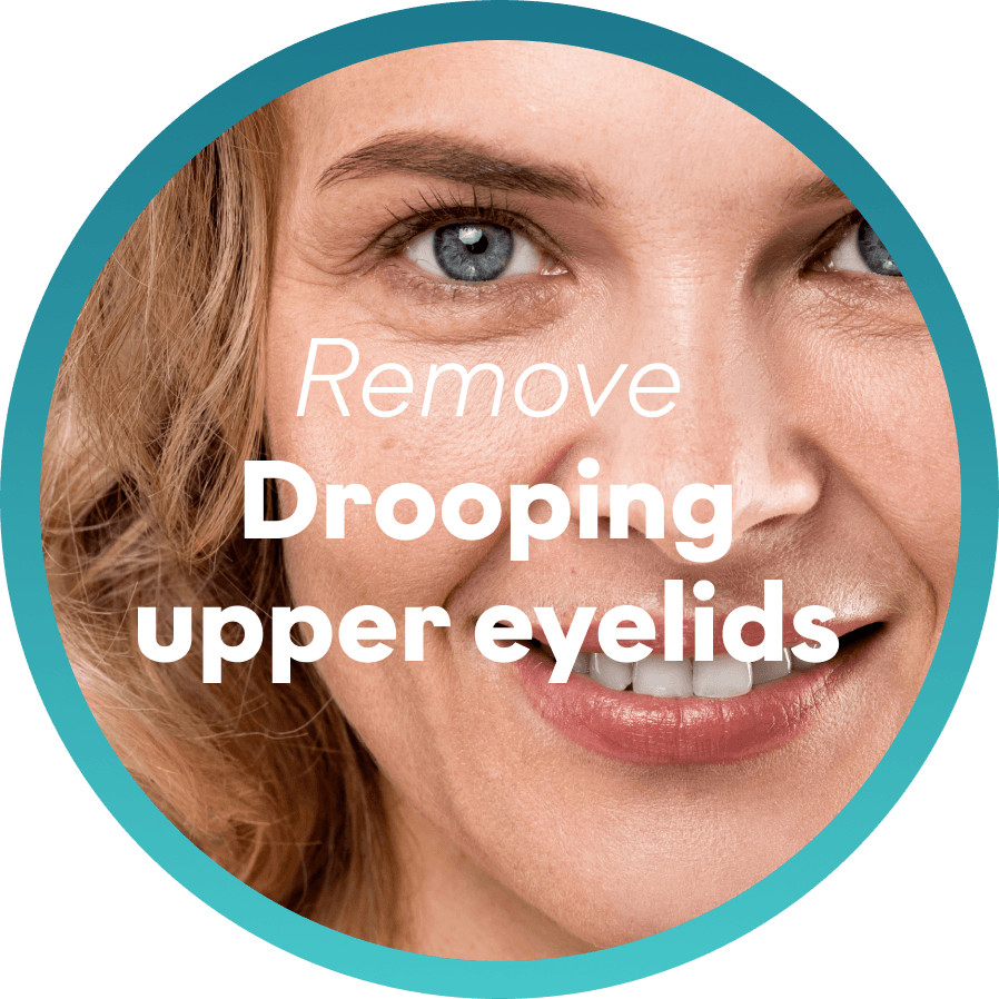Remove Drooping upper eyelids