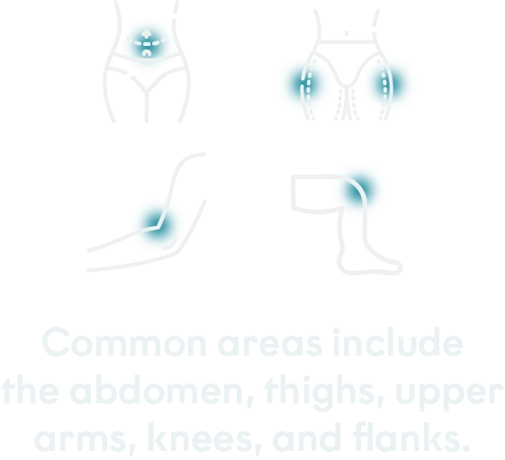 Treated areas mobile