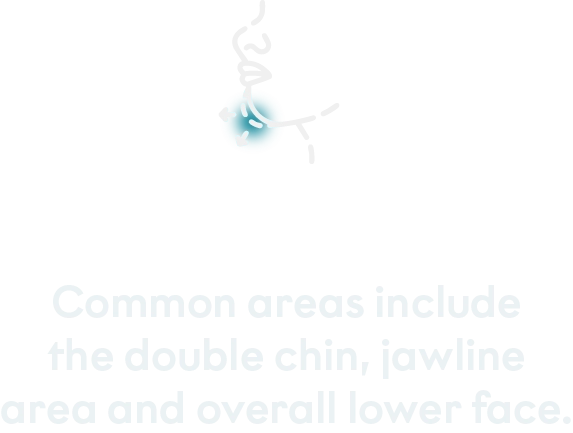 Treated areas mobile