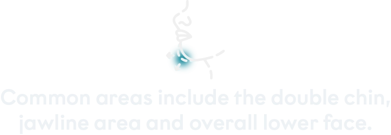 Treated areas desktop