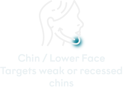 Treated areas mobile