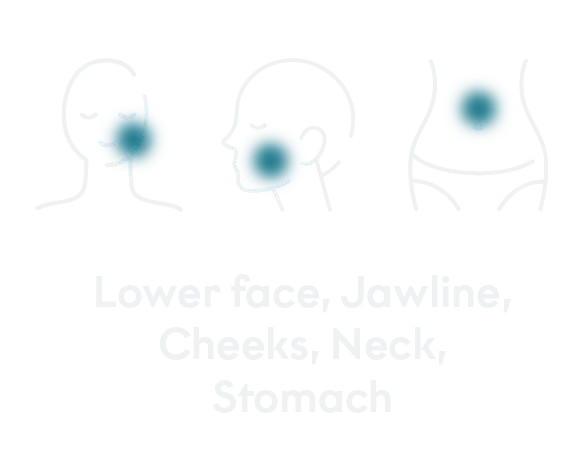 Treated areas mobile