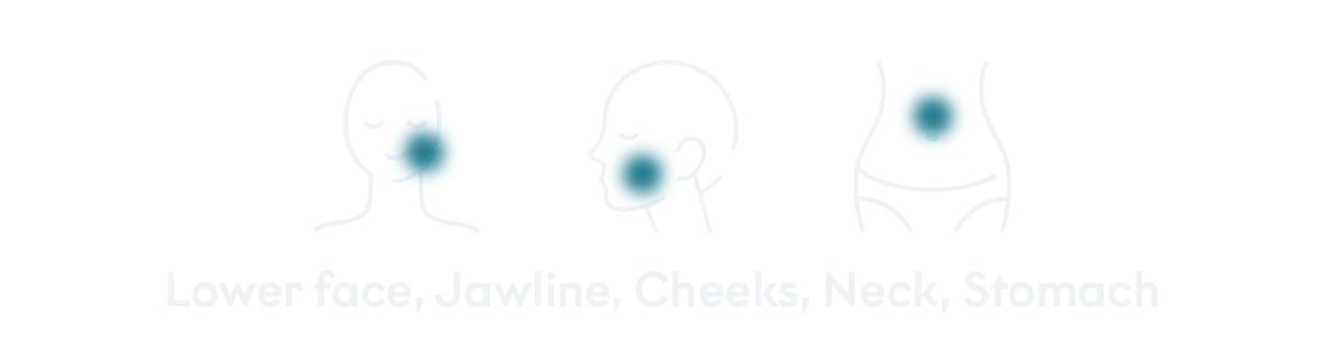 Treated areas desktop