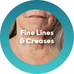 Fine Lines & Creases