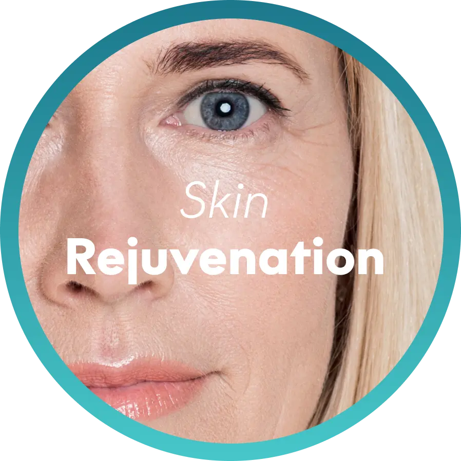  Fine lines and wrinkles