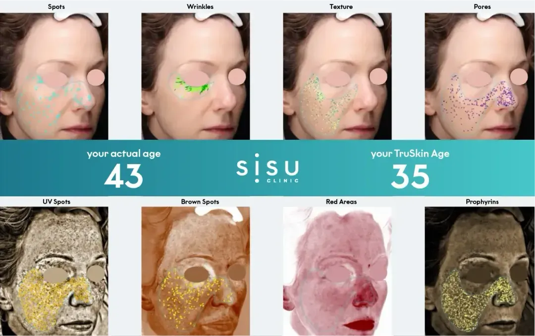 Before and after Exosomes Treatment result