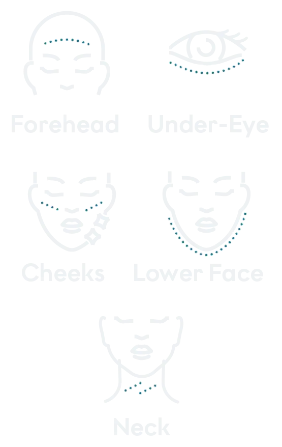 Treated areas mobile