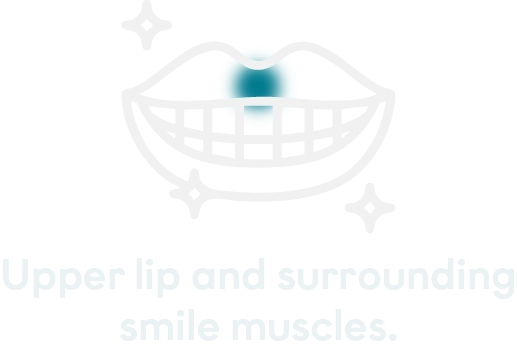 Treated areas mobile