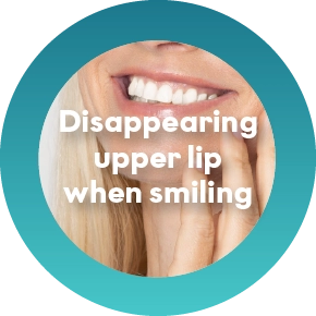  Disappearing upper lip when smiling 