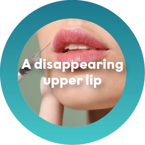  A disappearing upper lip