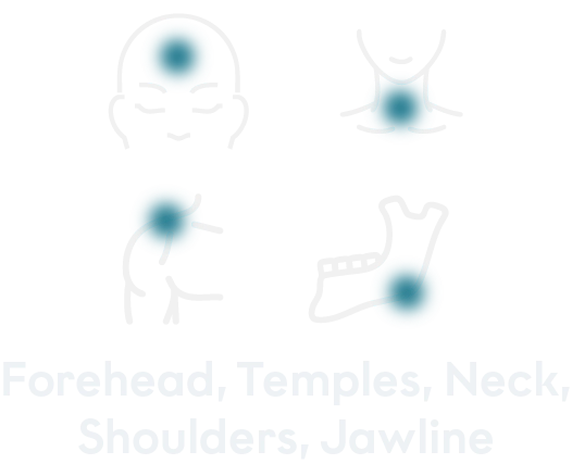 Treated areas mobile