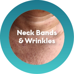 Neck Bands & Wrinkles