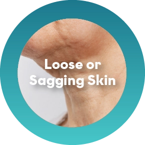 Loose or Sagging Skin