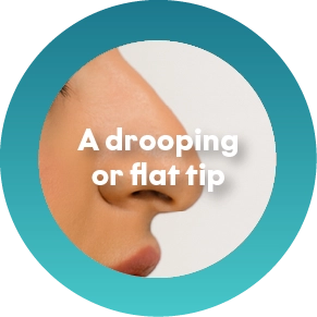 A drooping or flat tip
