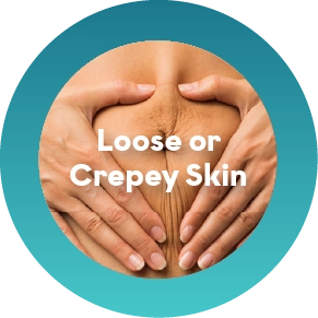 Crepey or Loose Skin