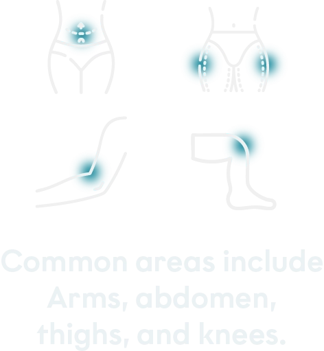 Treated areas mobile