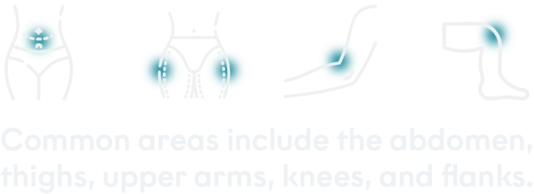 Treated areas desktop