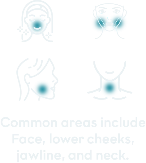 Treated areas mobile