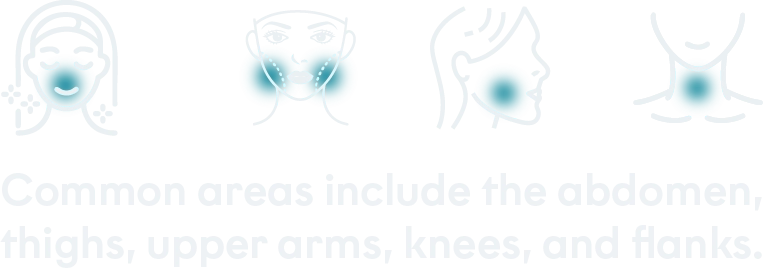 Treated areas desktop