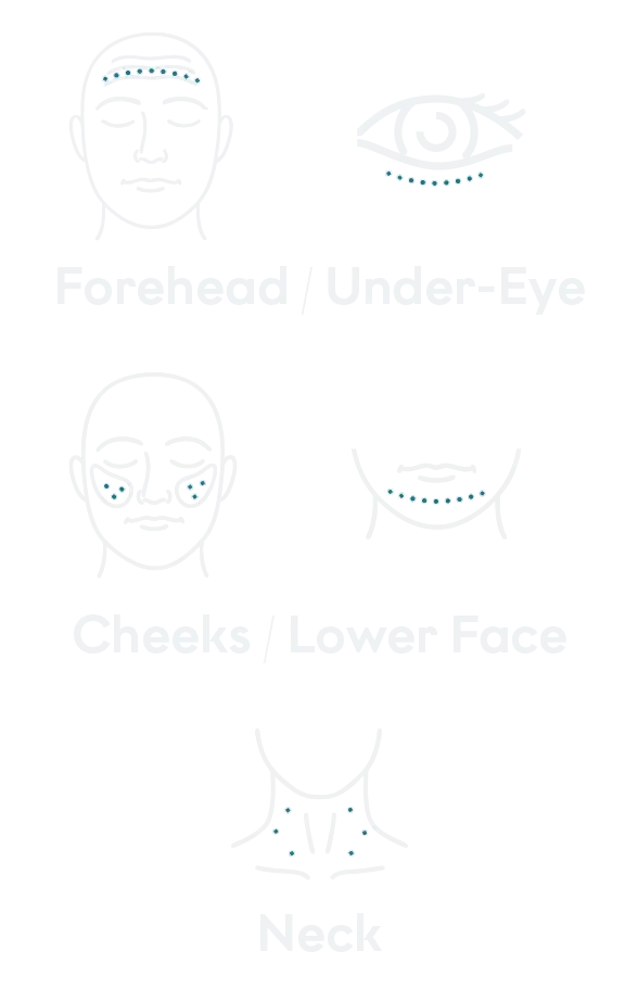 Treated areas mobile