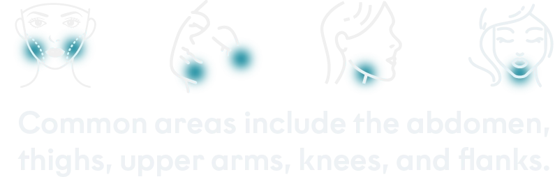 Treated areas desktop