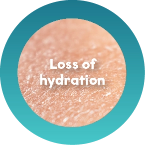 Dry, Dehydrated Skin