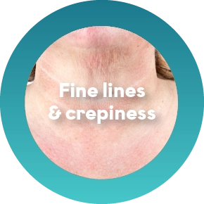 Dull or Uneven Skin Tone