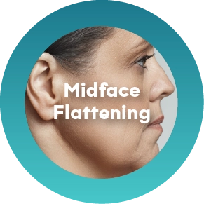 Reduced Support in the Cheeks