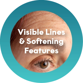 Under-Defined Features