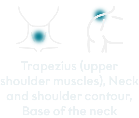 Treated areas mobile