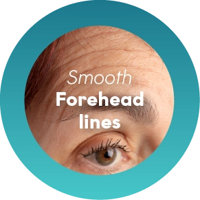 Forehead lines