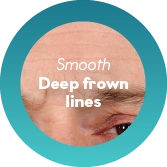 Deep Frown or Forehead Lines