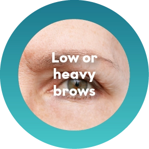 Low or Heavy Brows