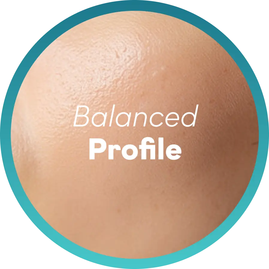 Sagging or Drooping Midface