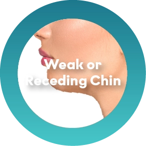 Weak or Recessed Chin