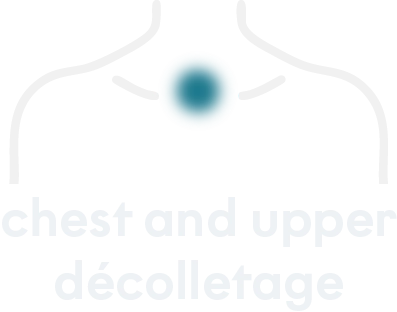 Treated areas mobile