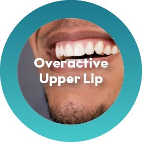 Overactive Upper Lip Muscles
