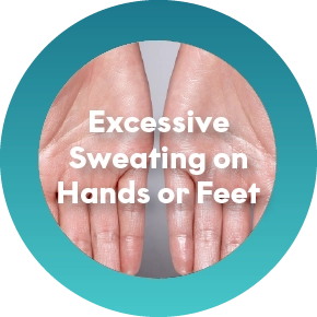 Sweaty Hands or Palms