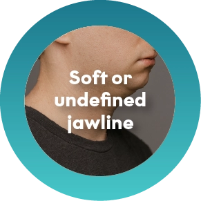 Lack of Jaw Definition