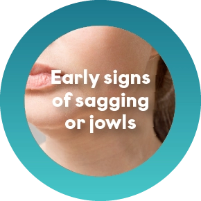 Soft or Sagging Lower Face