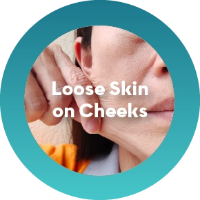 Loss of Facial Definition