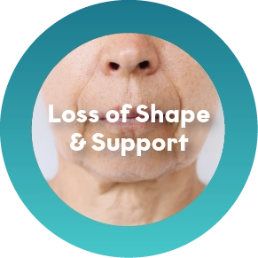 Wrinkles Caused by Facial Expression