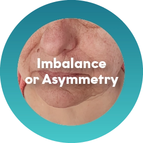 Early Loss of Skin Firmness