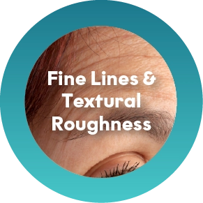 Skin That Looks Dull or Flat