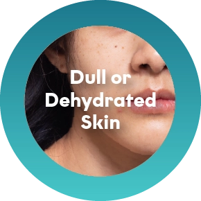 Fine Lines Caused by Facial Movement