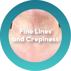 Rough Texture or Fine Irregularities