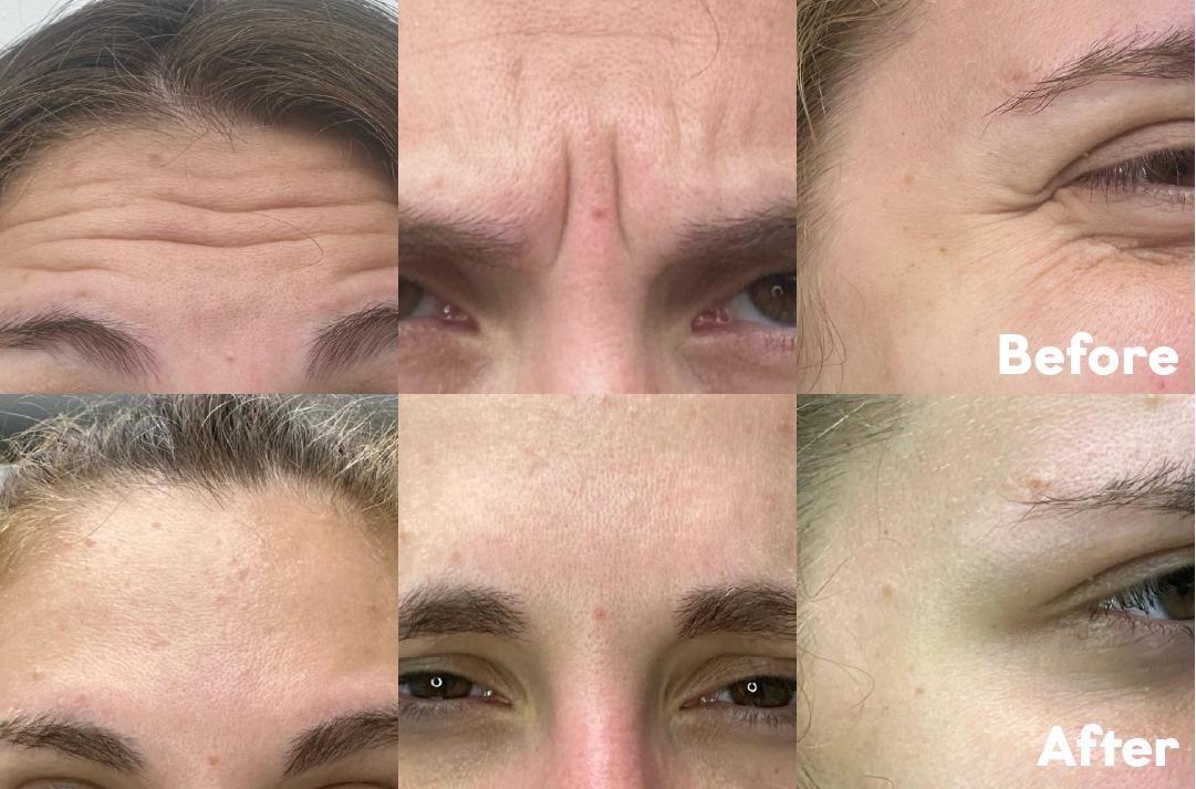 Before and after The Taylor Package result