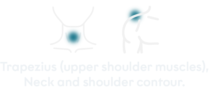 Treated areas desktop