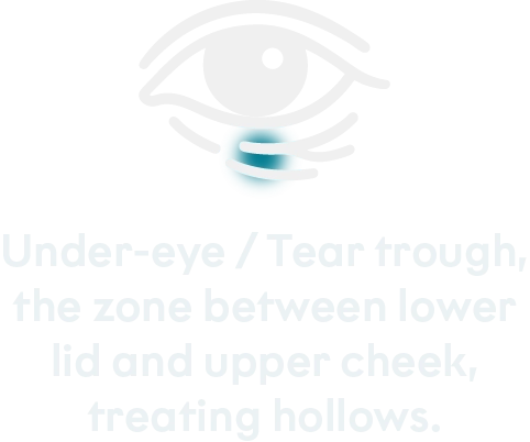 Treated areas mobile